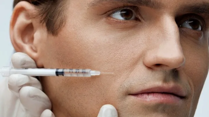 Injection d'acide hyaluronique chez un patient homme, zone pommette et contour du visage