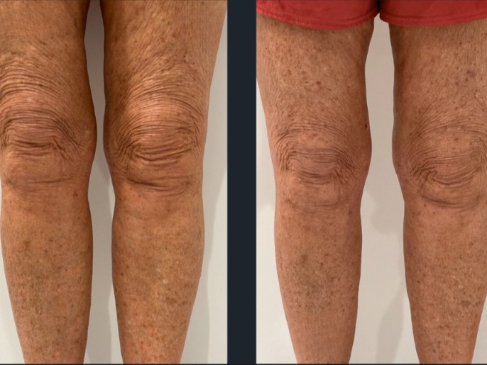 Attiva — Beauvoir Clinic, Waterloo