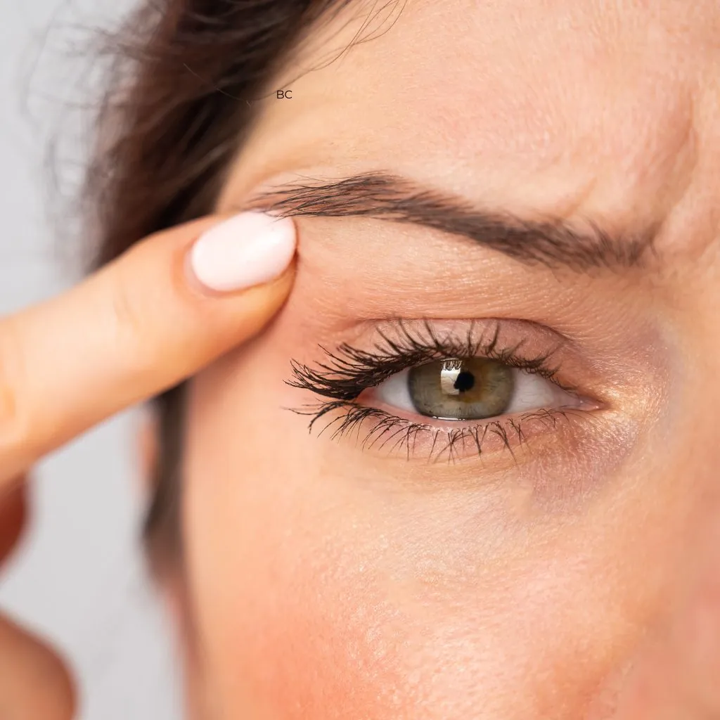 Paupière supérieure relâchée examinée en consultation de blépharoplastie — Beauvoir Clinic, Waterloo