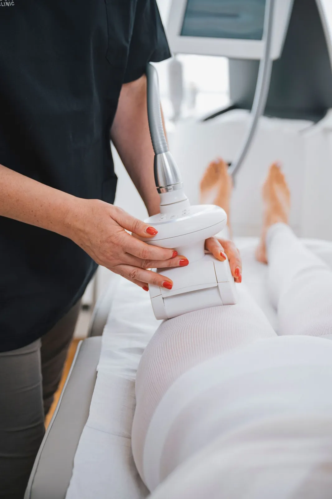 Endermologie LPG : la kinésithérapeute guide la tête de traitement le long de la cuisse — Waterloo