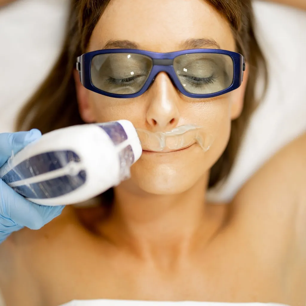Épilation laser visage (lèvre supérieure, menton) — Beauvoir Clinic, Waterloo