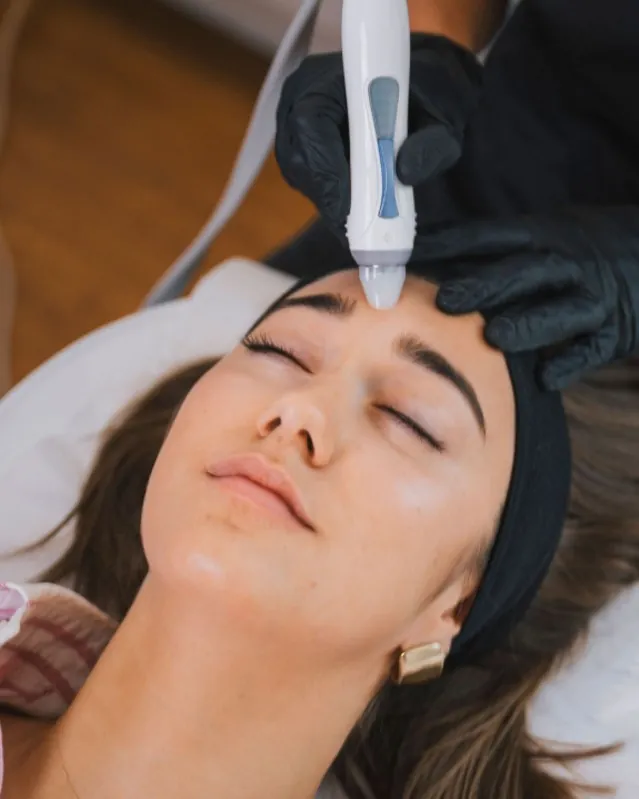 Soin Inpure HydraJet : pièce à main d'hydradermabrasion sur le front — Beauvoir Clinic, Waterloo