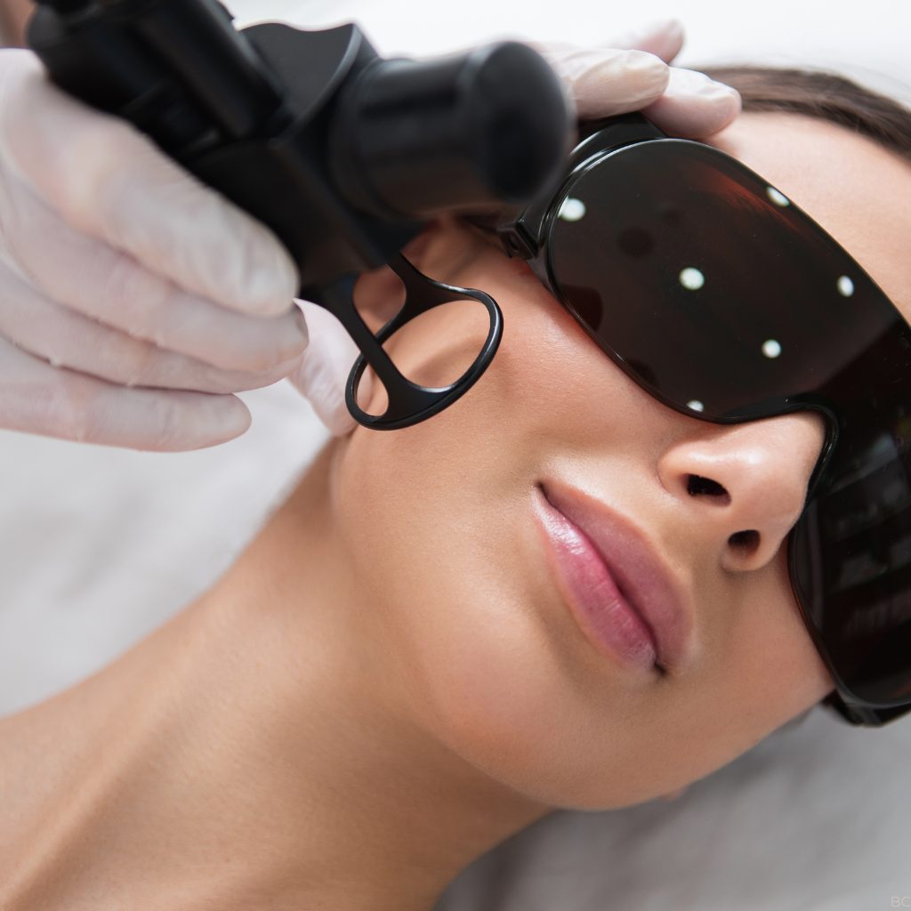 Laser CO2 — geste technique — Beauvoir Clinic, Waterloo