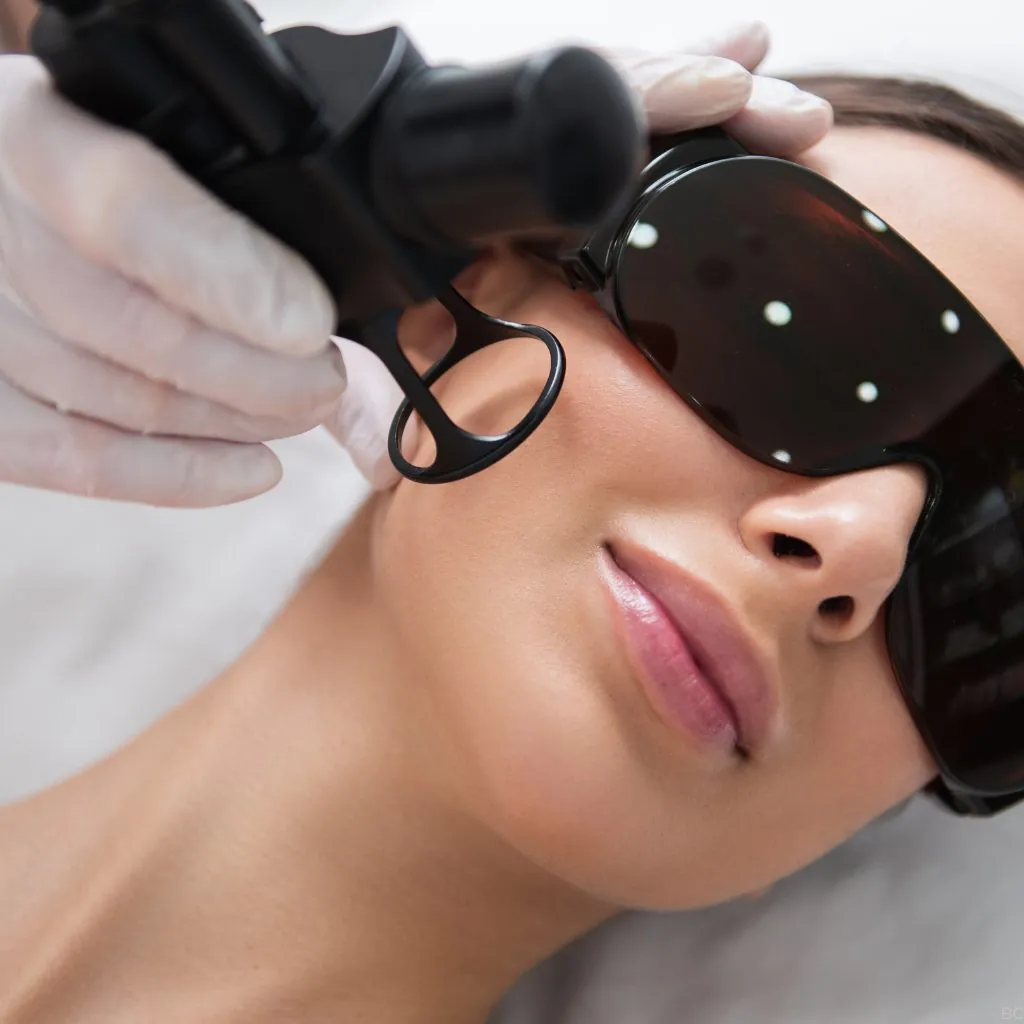 Laser CO₂ fractionné à Waterloo — Beauvoir Clinic