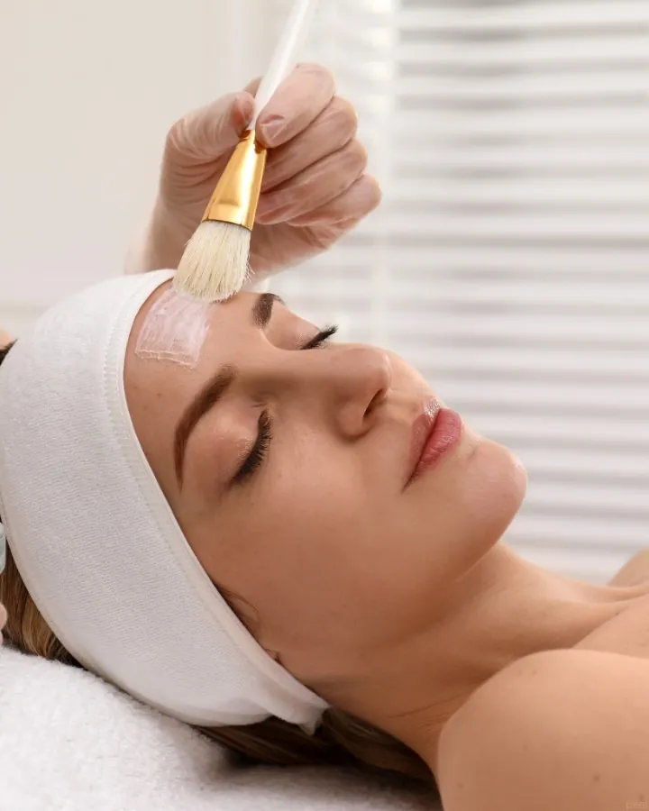 Application d'un peeling médical au pinceau sur le front — Beauvoir Clinic, Waterloo