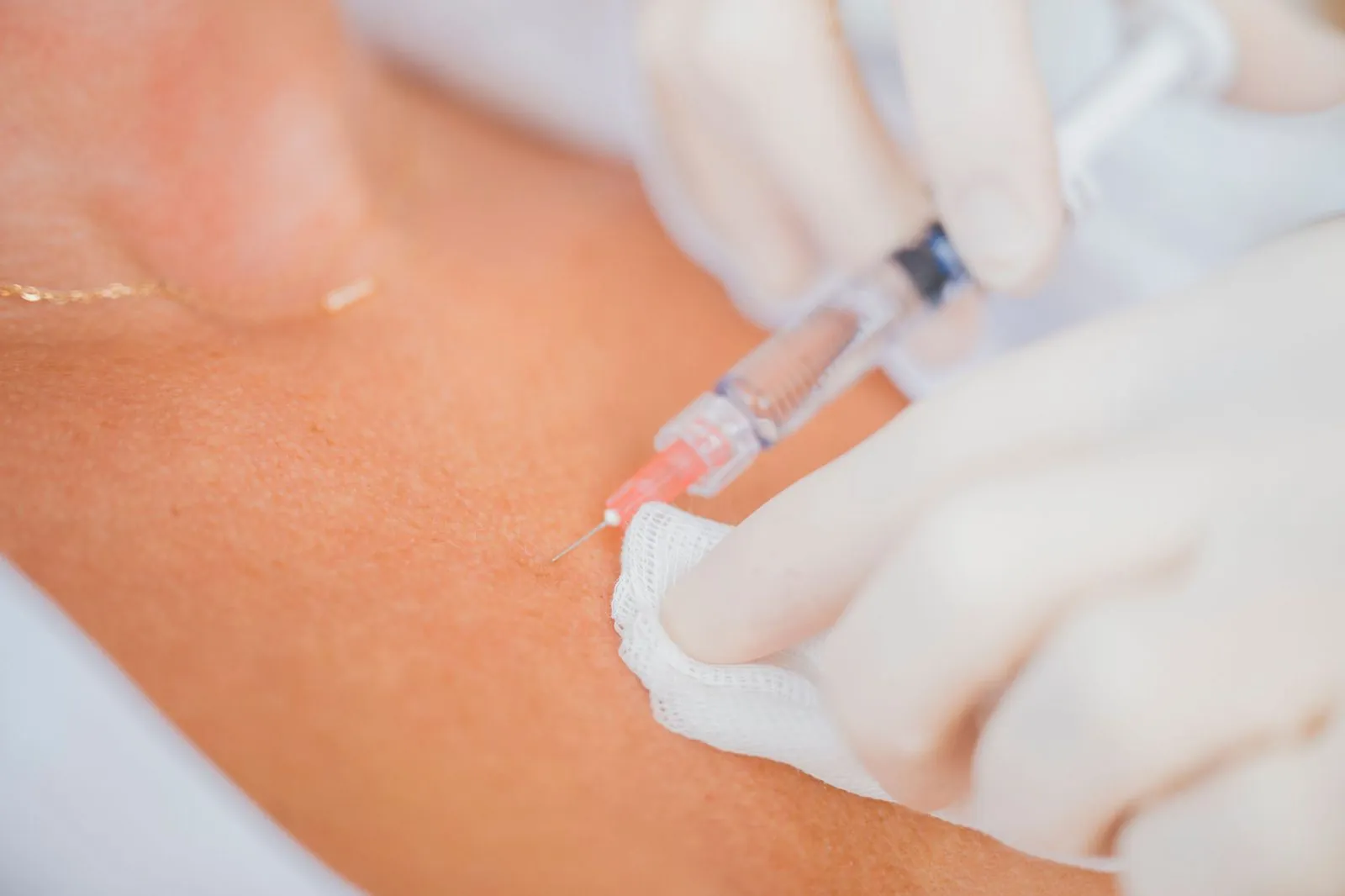 Injection de skinbooster Profhilo, gros plan sur la seringue — Beauvoir Clinic, Waterloo
