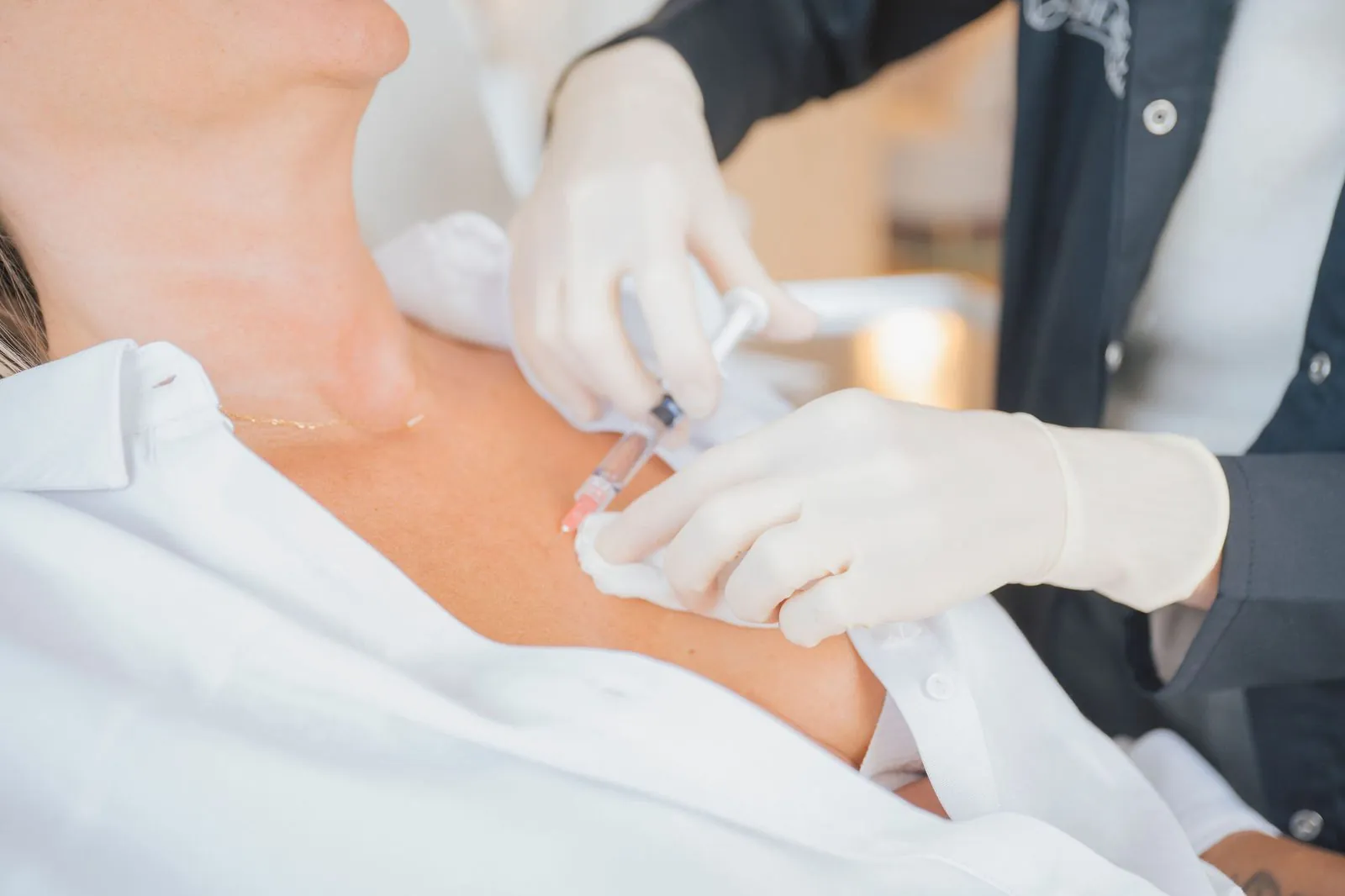 Injection Profhilo sur le décolleté — Beauvoir Clinic, Waterloo
