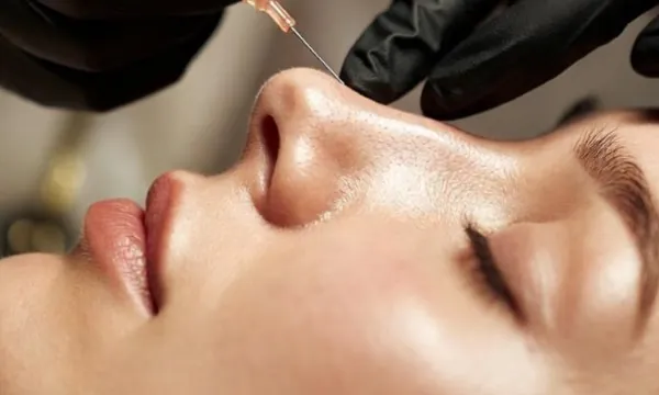 Rhinoplastie médicale — analyse du profil — Beauvoir Clinic, Waterloo