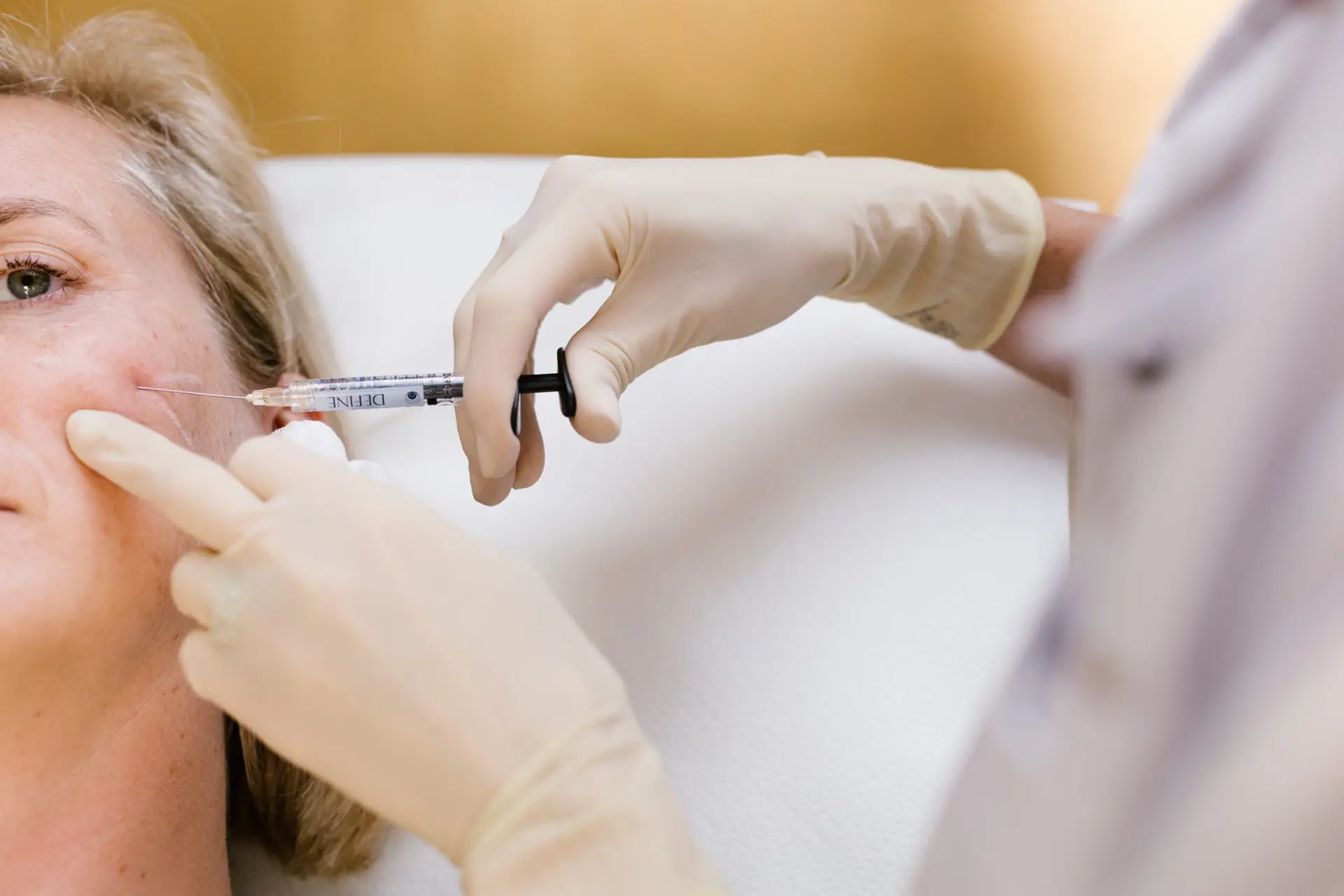 Injection esthétique sur le visage d'une femme