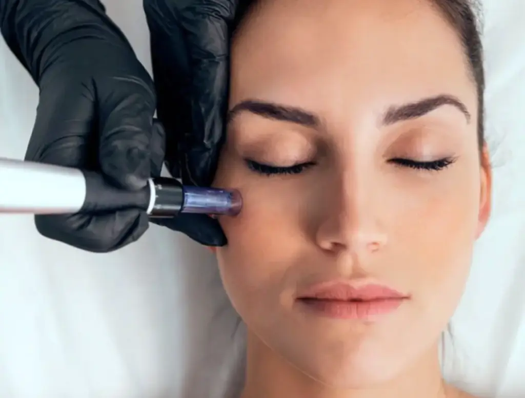 Traitement du visage par microneedling en institut